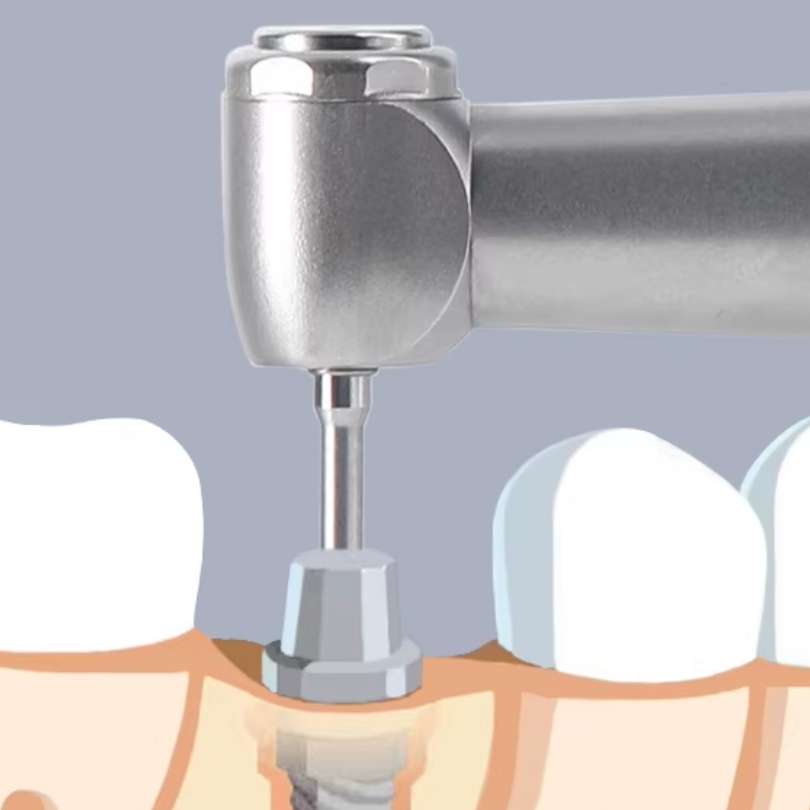전기 토크 렌치 16개 팁 + 콘트라앵글 포함