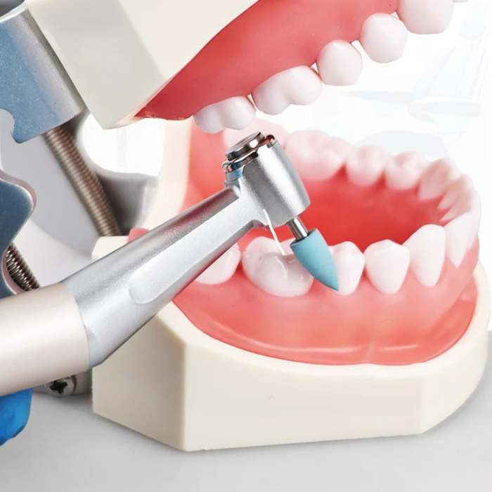 수지용 연마 및 마감 키트 – 12개 세트 (저속)
