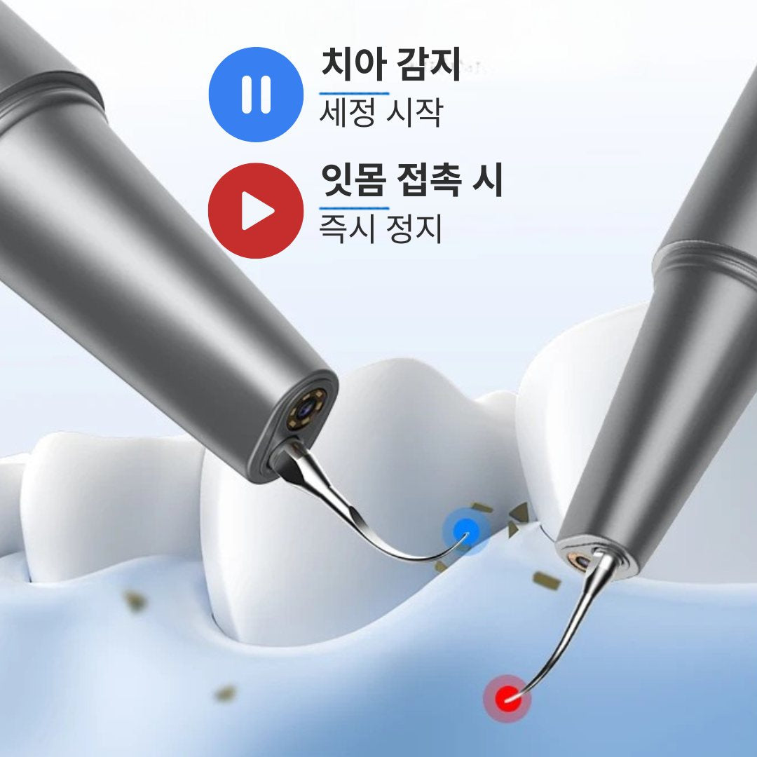 스마트 센서: 치아를 감지해 세정 시작, 잇몸에 닿으면 일시정지