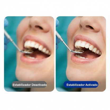 의료·치과·에스테틱 시술용 녹화 카메라 – 4K 30FPS